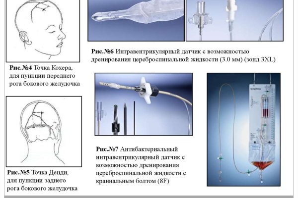 Угнали аккаунт кракен