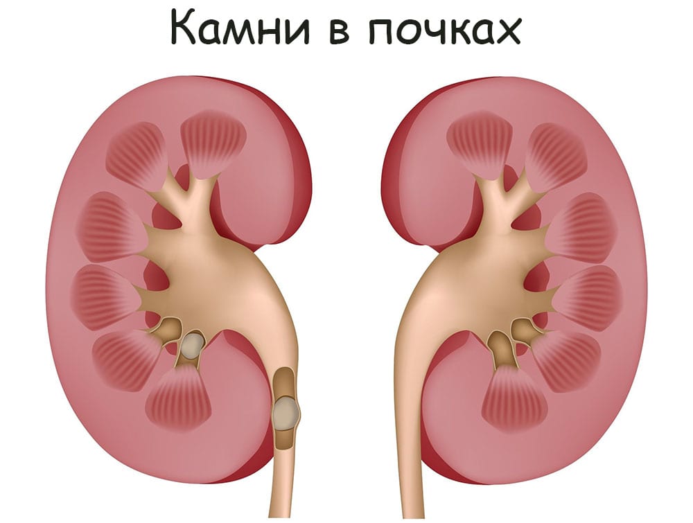 Кракен даркнет отзывы